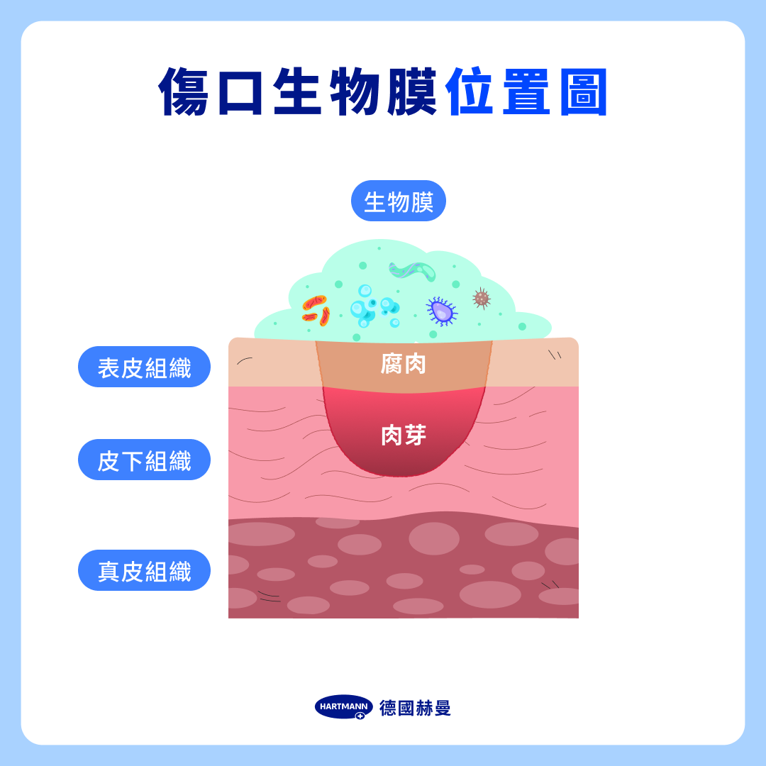 傷口生物膜