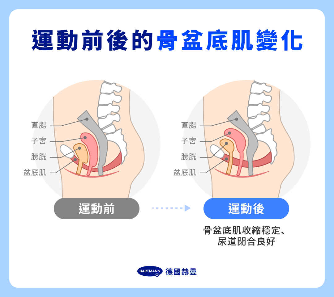 運動前後的骨盆底肌變化