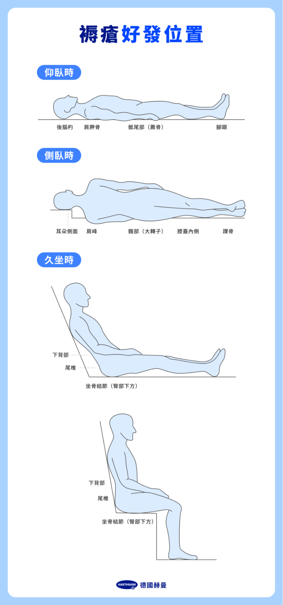 褥瘡好發位置