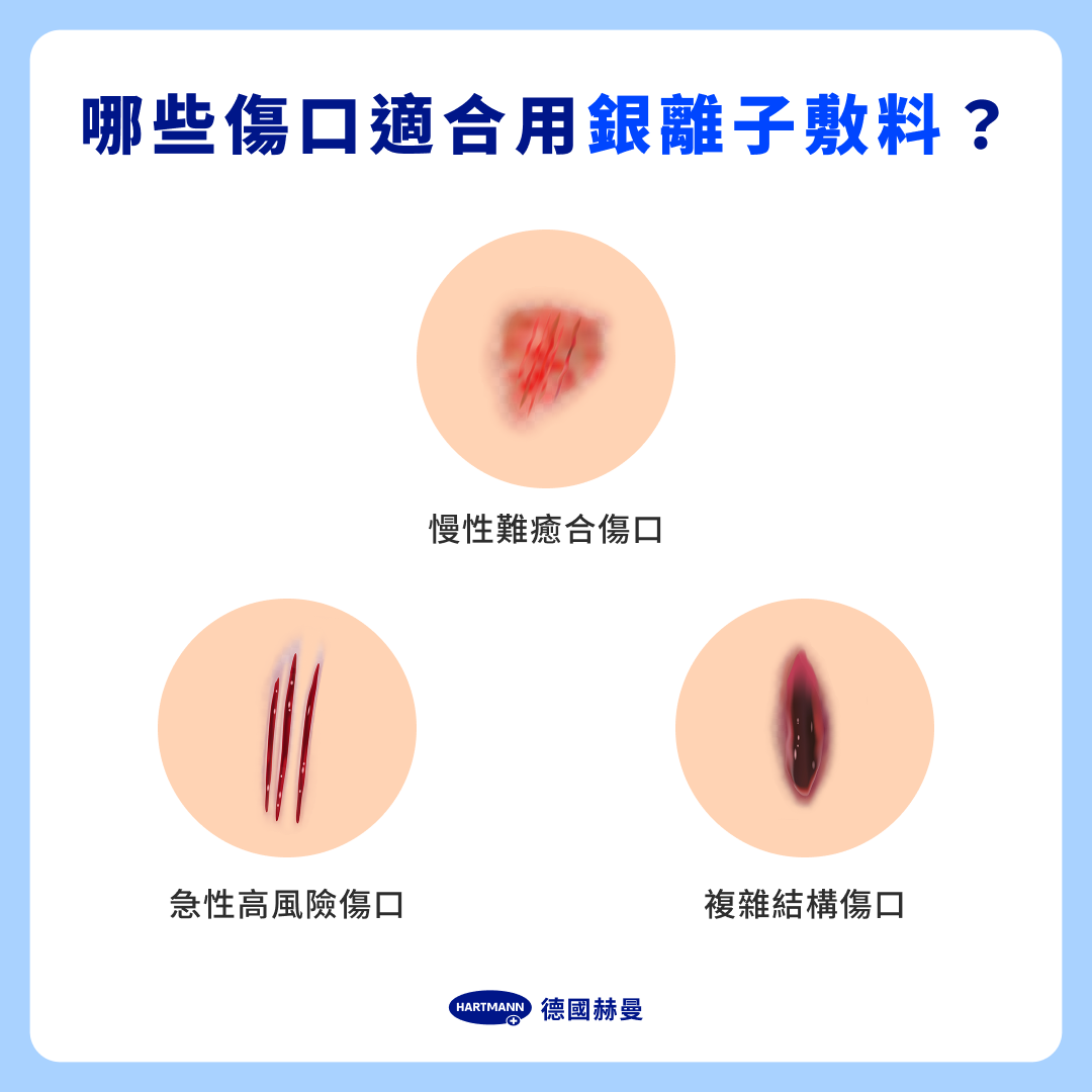 哪些傷口適合用銀離子敷料?